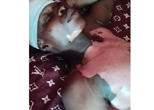 Vandal Gets Electrocuted, Other Arrested After Plundering Transformer At Abiye Prayer Ground Ede